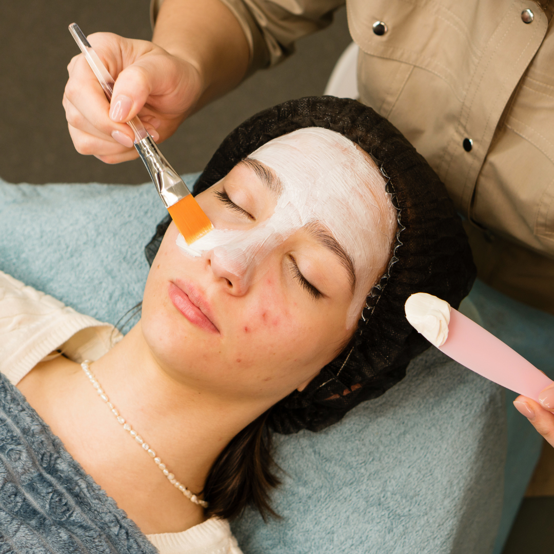(Test) Acne skin scare top tips